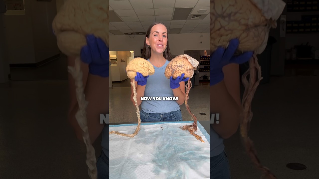 🧠 Human Brain FAQ! 🧠 #anatomy #organs #humanbody #humananatomy #brain #science #scienceteacher