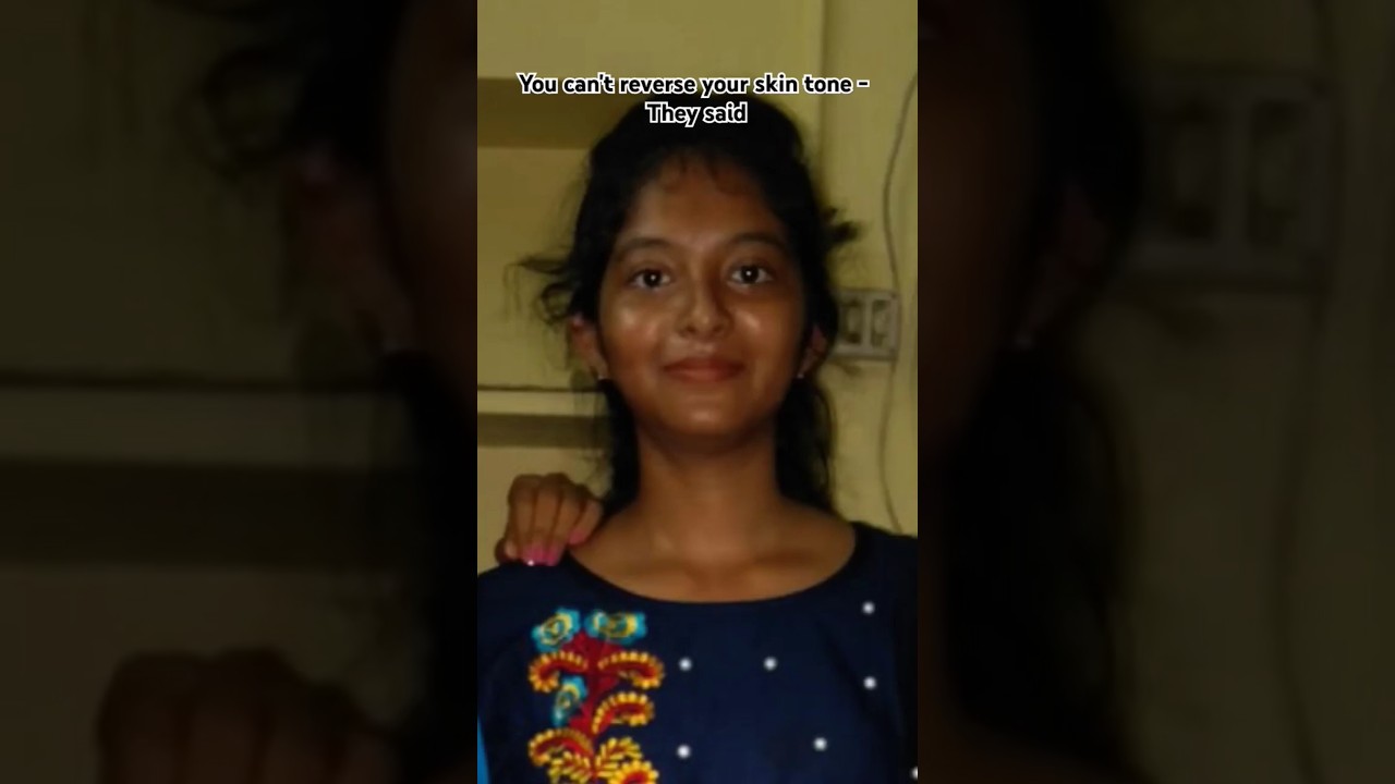 How i removed my tanning 🕶🧿. follow for more #skincare #brightskin #shorts #skinroutine #youngerskin