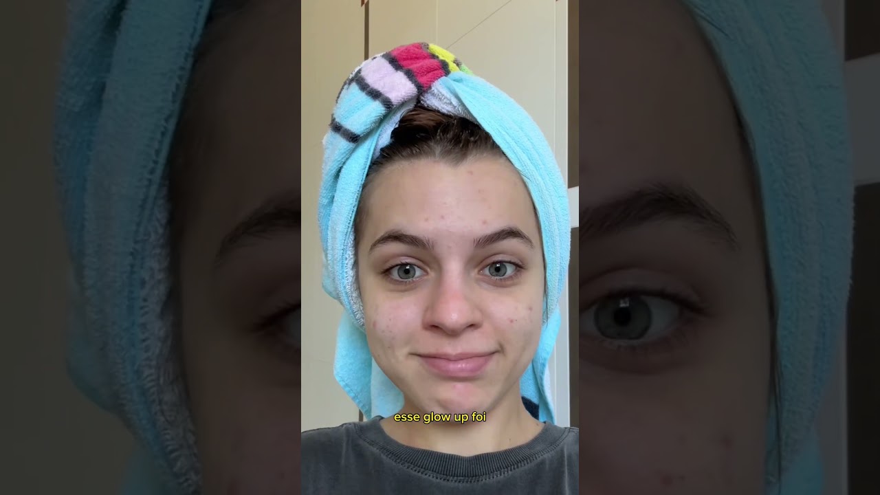 TENTANDO TER A PELE PERFEITA SÓ COM SKIN CARE – SEMANA 2