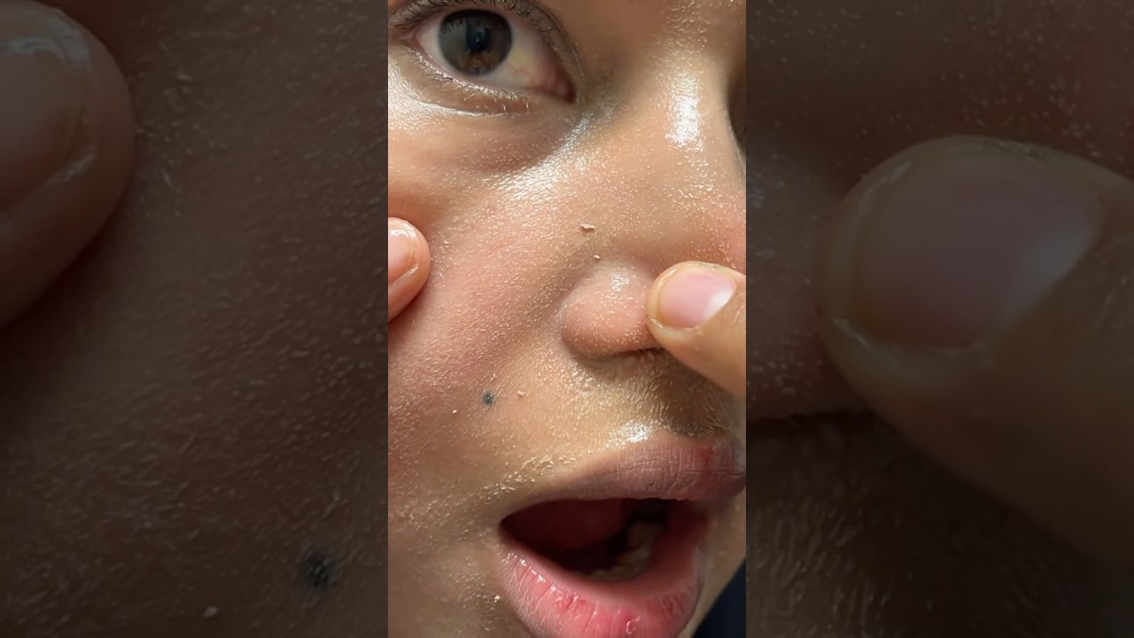 VIRAL Korean Skincare Products fromANUA ✅ #anua#skincare #skincareroutine #koreanskincare #kbeauty