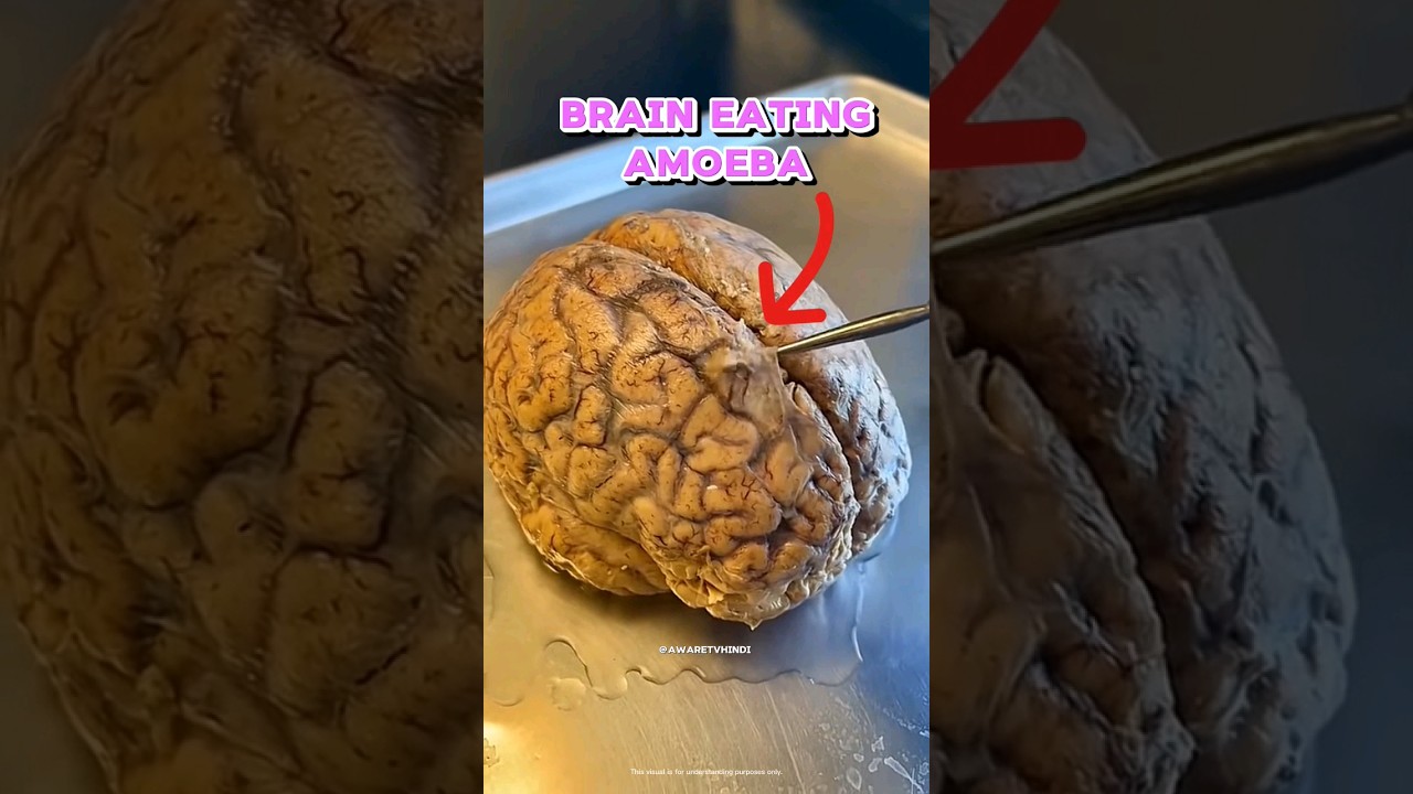 Deadly Brain eating amoeba #science #awareness
