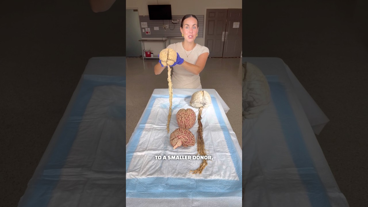 Real human brains! 🧠👀 #anatomy #organs #brains #humanbody #science #scienceteacher #education