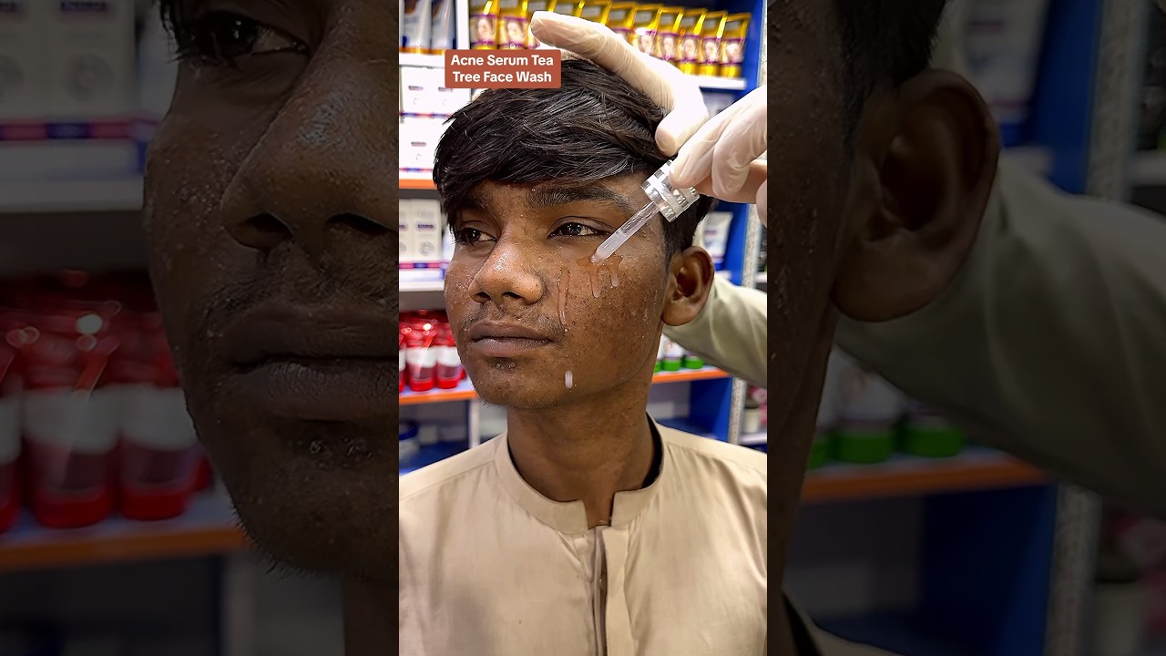Glow & Clean Acne Serum & Tea Tree Face Wash Amazing #ameenbeautytips