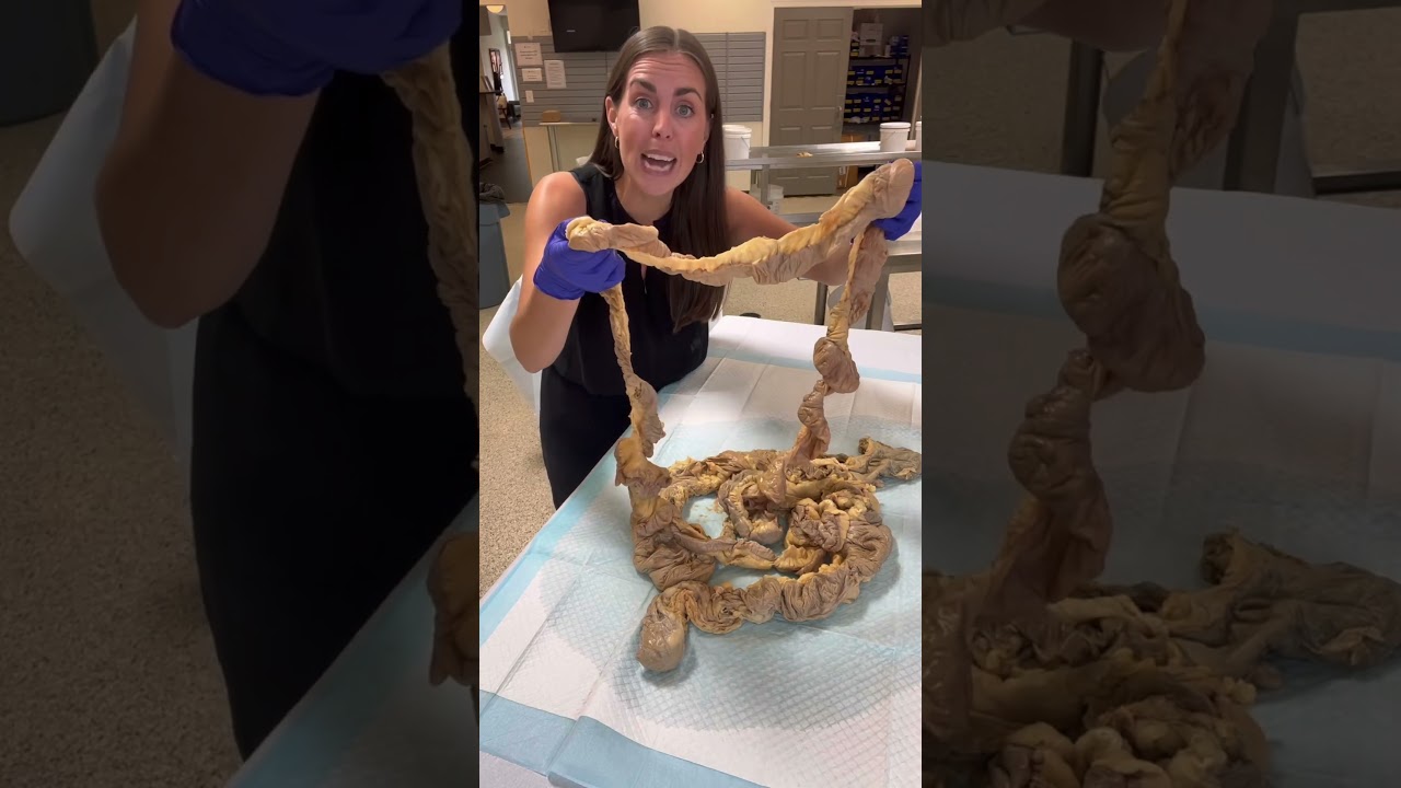 The digestive system is amazing! #anatomy #humanbody #science #stem #intestines #digestivesystem