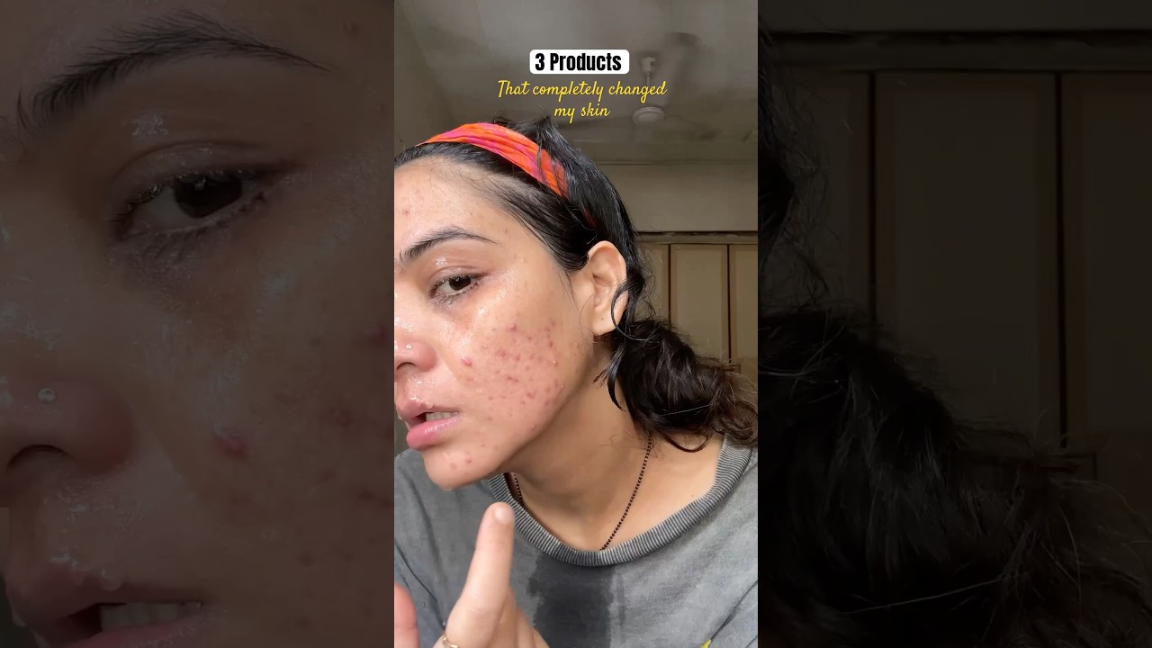 Products that changed my skin completely! #skincare