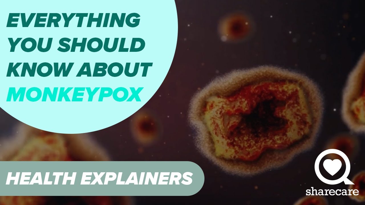 What You Need to Know About Monkeypox | Health Explainers | Sharecare