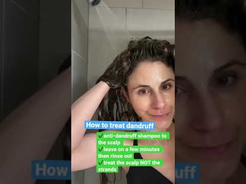 How to TREAT DANDRUFF #Shorts